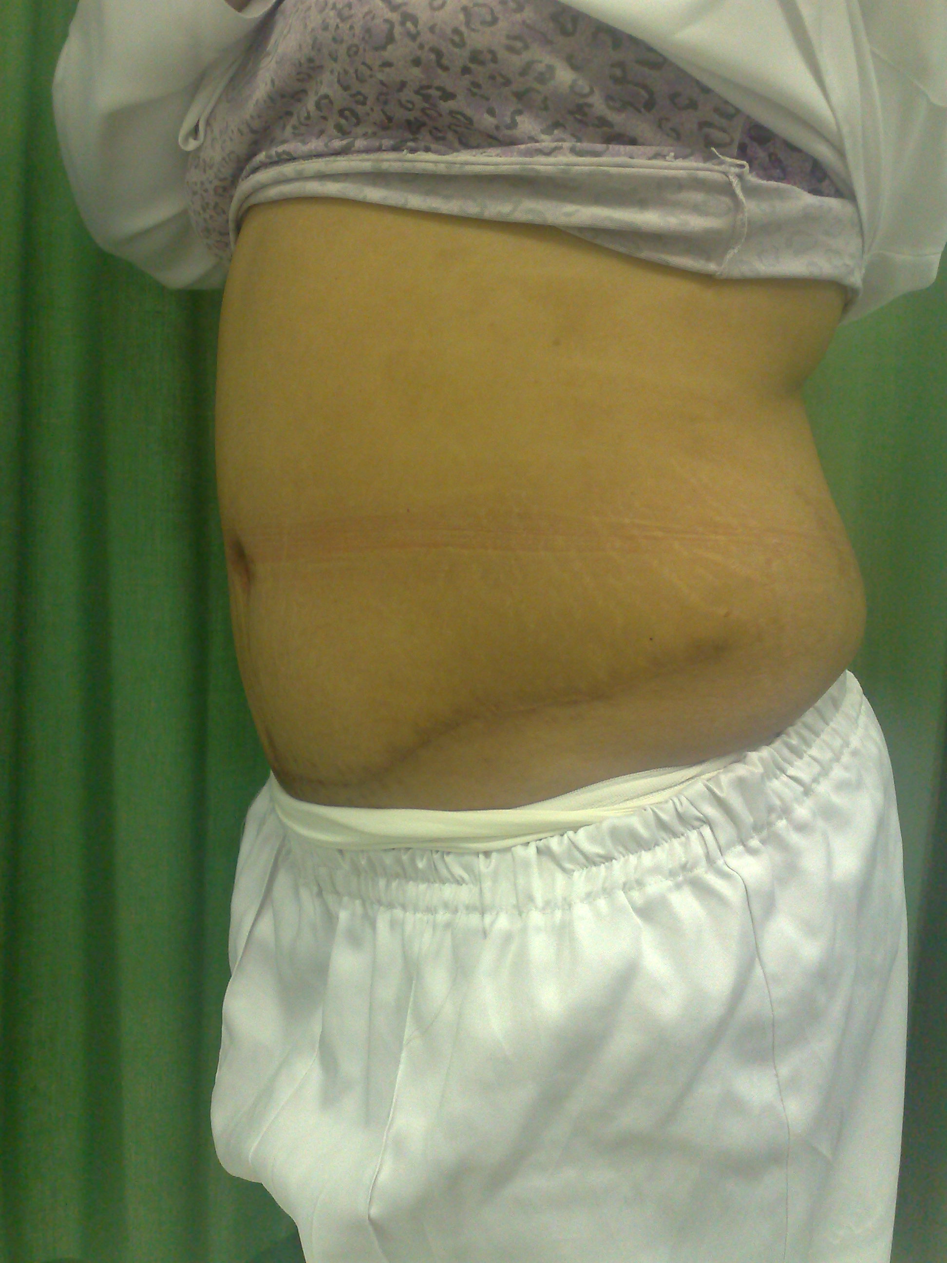 After