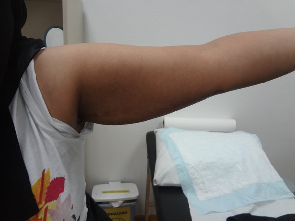 After