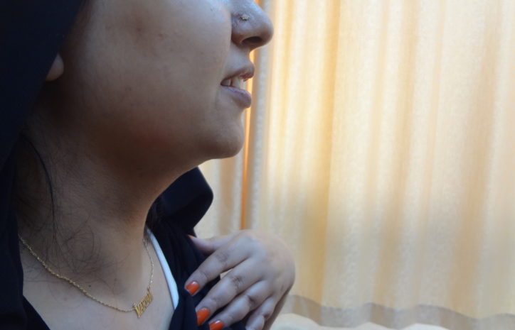 After